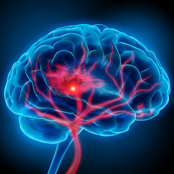NEUROLOGY